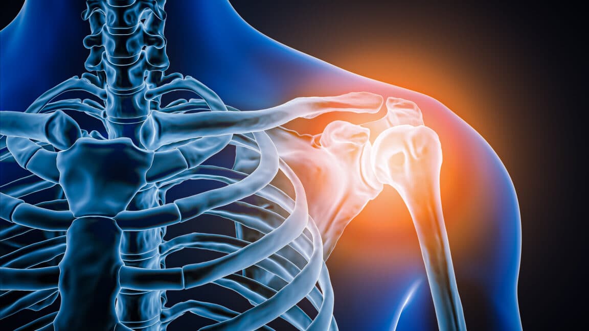 Missing Joint: Surgeons Stunned by Unprecedented Shoulder Discovery
